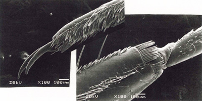 マツモムシの足の電子顕微鏡の写真